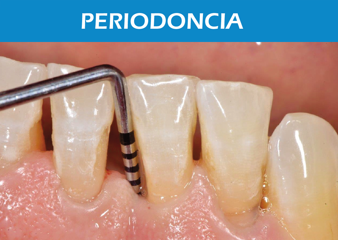 Periodoncia2